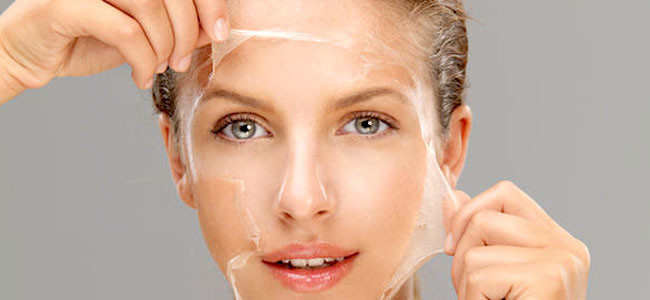 Chemical Peel @Accent-Beauty